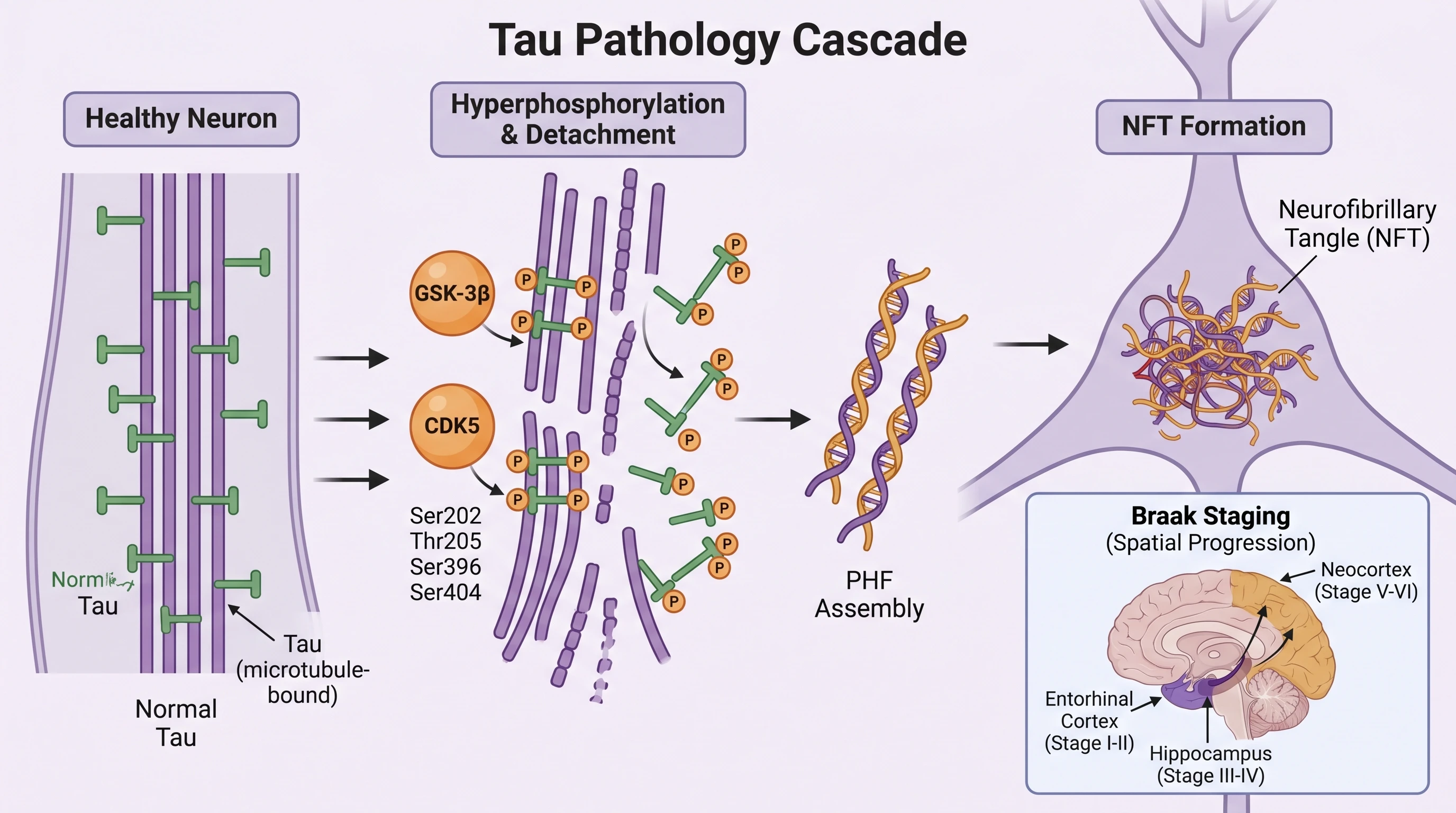 Tau hyperphosphorylation at Ser202, Thr205, Ser396, Ser404 by GSK-3-beta and CDK5 forming paired helical filaments and intracellular NFTs (Figure generated with SciFig)