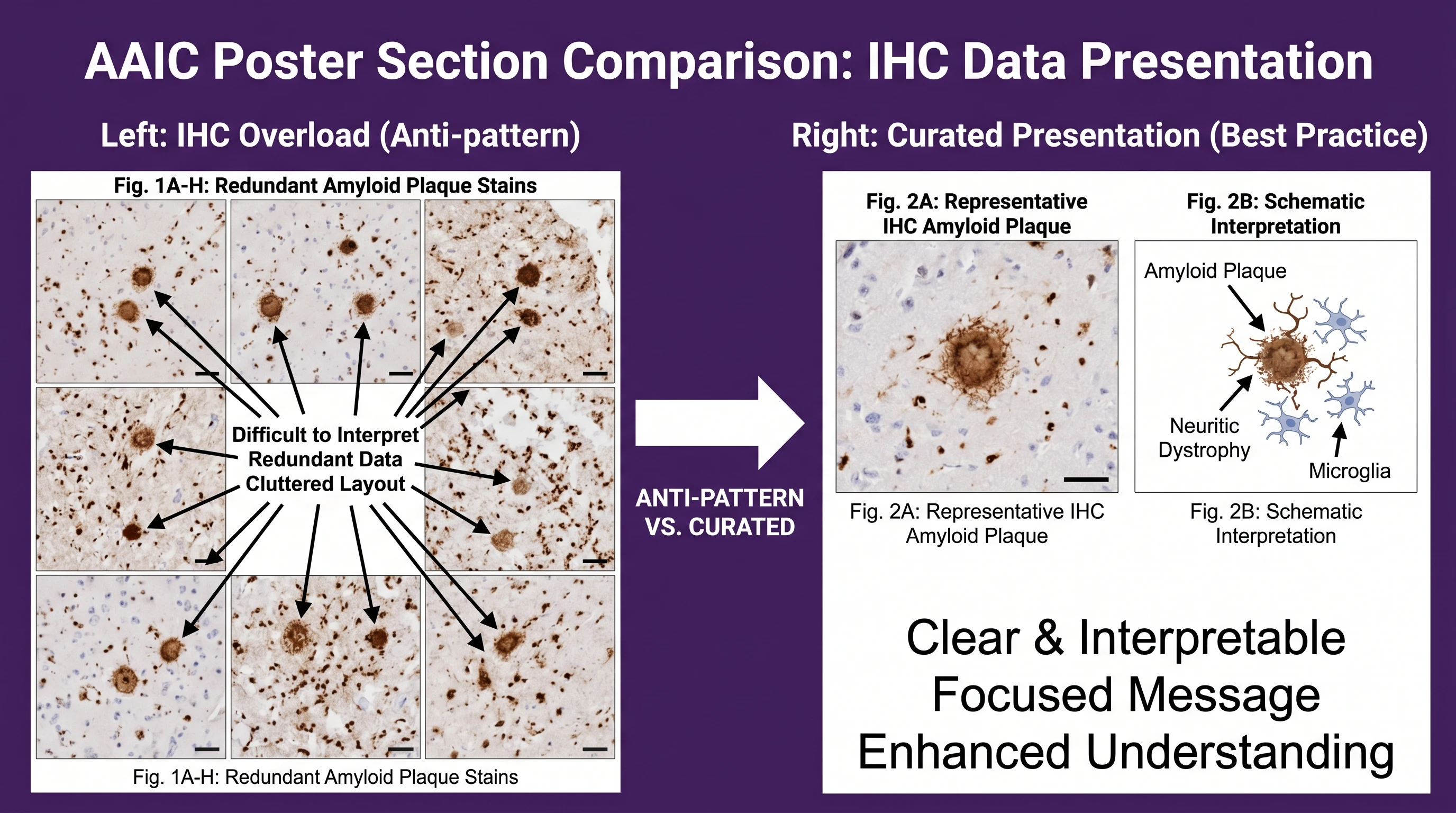 IHC layout — left 12 overcropped amyloid plaque IHC photos in chaotic grid, right 1 large representative plaque image plus 1 labeled schematic (Figure generated with SciFig)