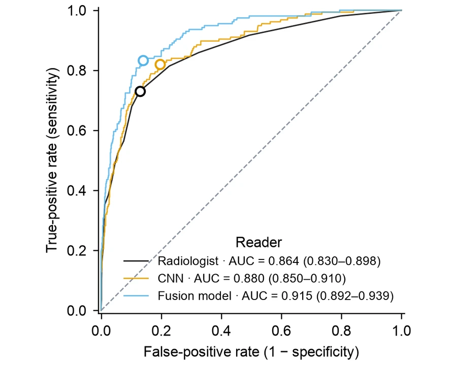 ROC curve — AI mammography reading
