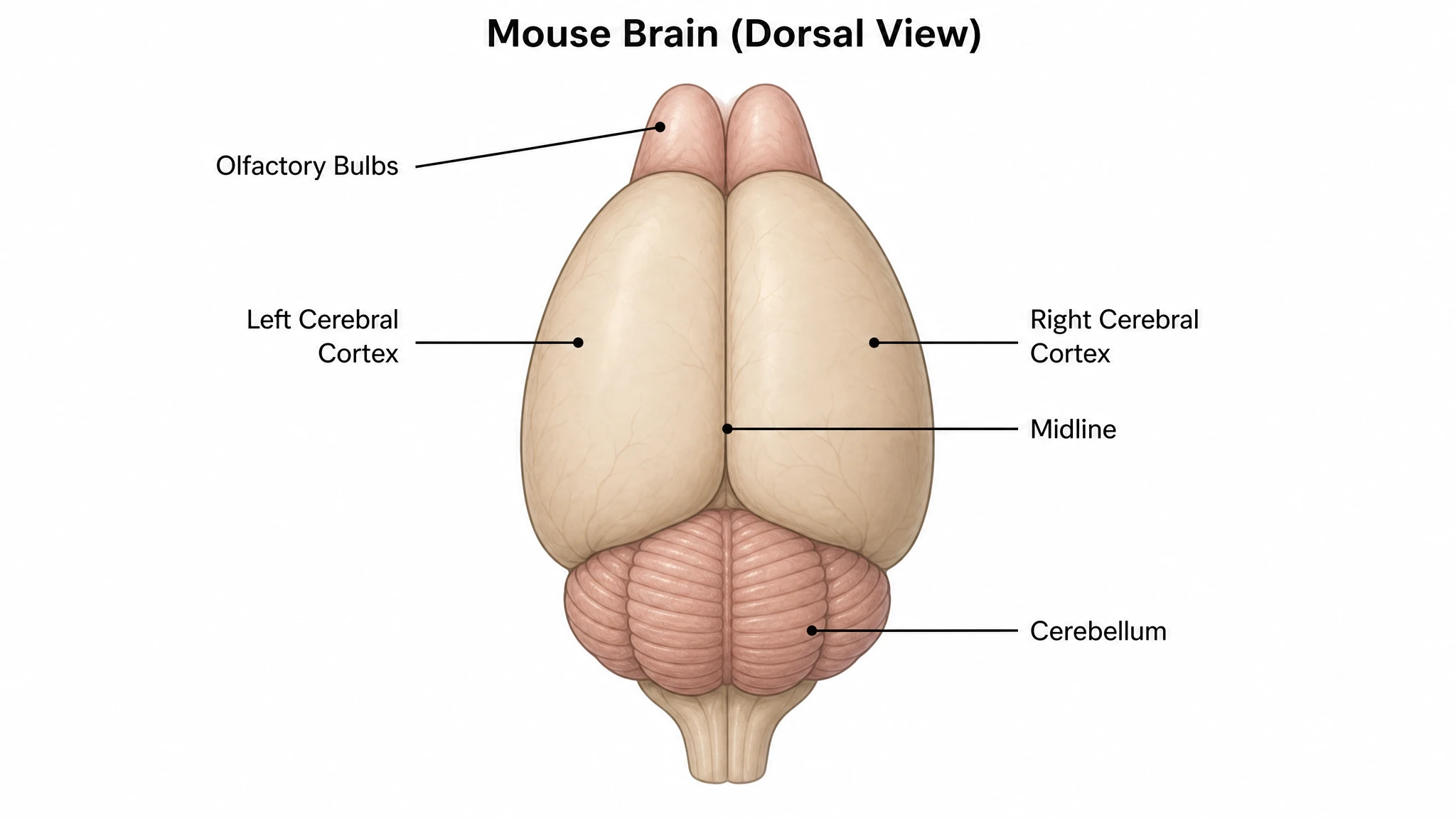 Dorsal view with the lissencephalic cortex labeled