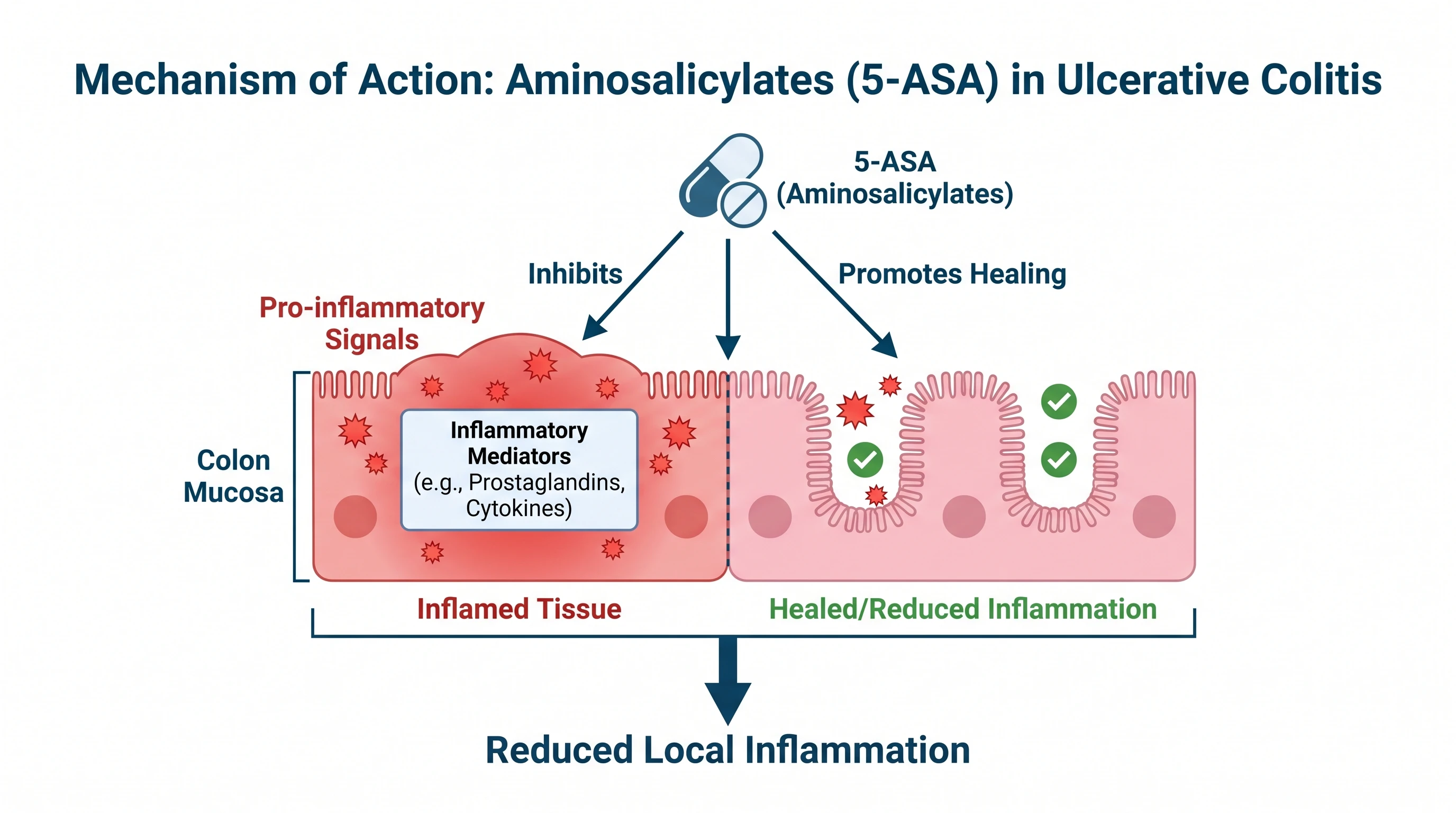 Show 5-ASA acting topically, not systemically