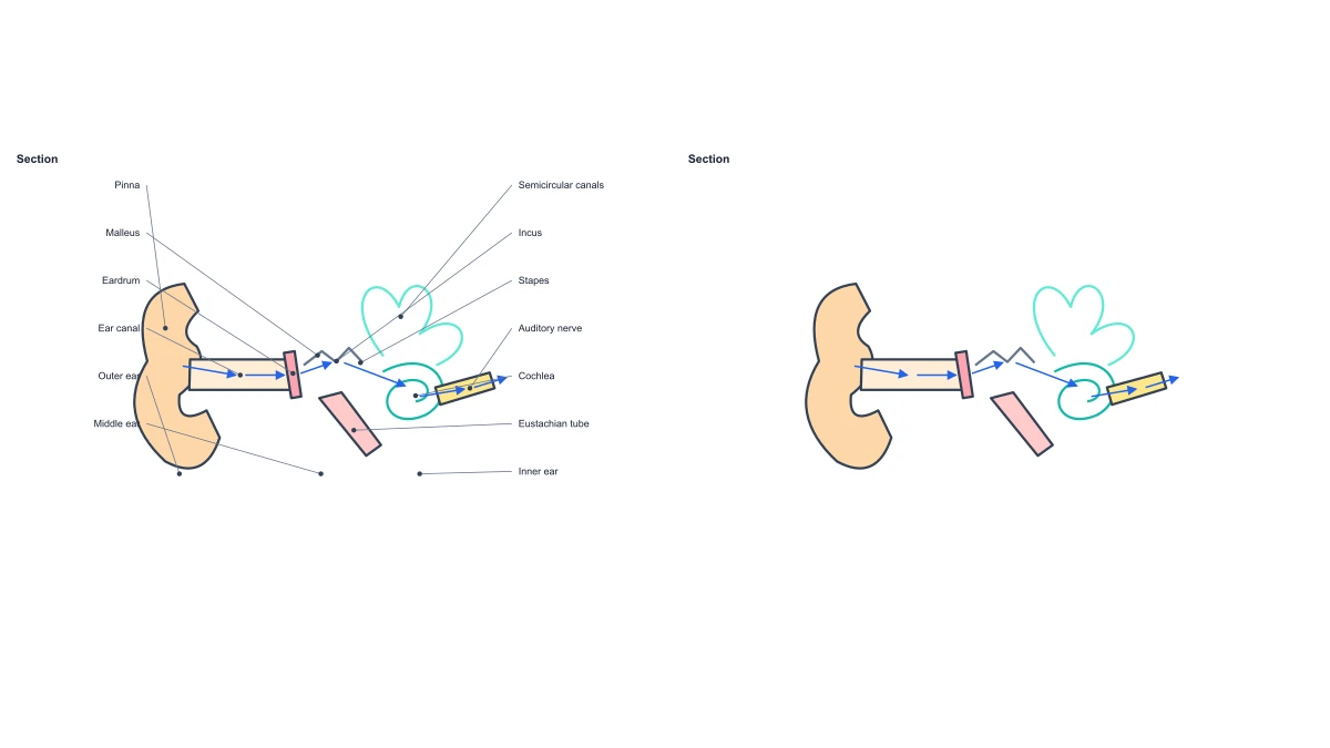 Beispielabbildung: Anatomisches Ohrdiagramm