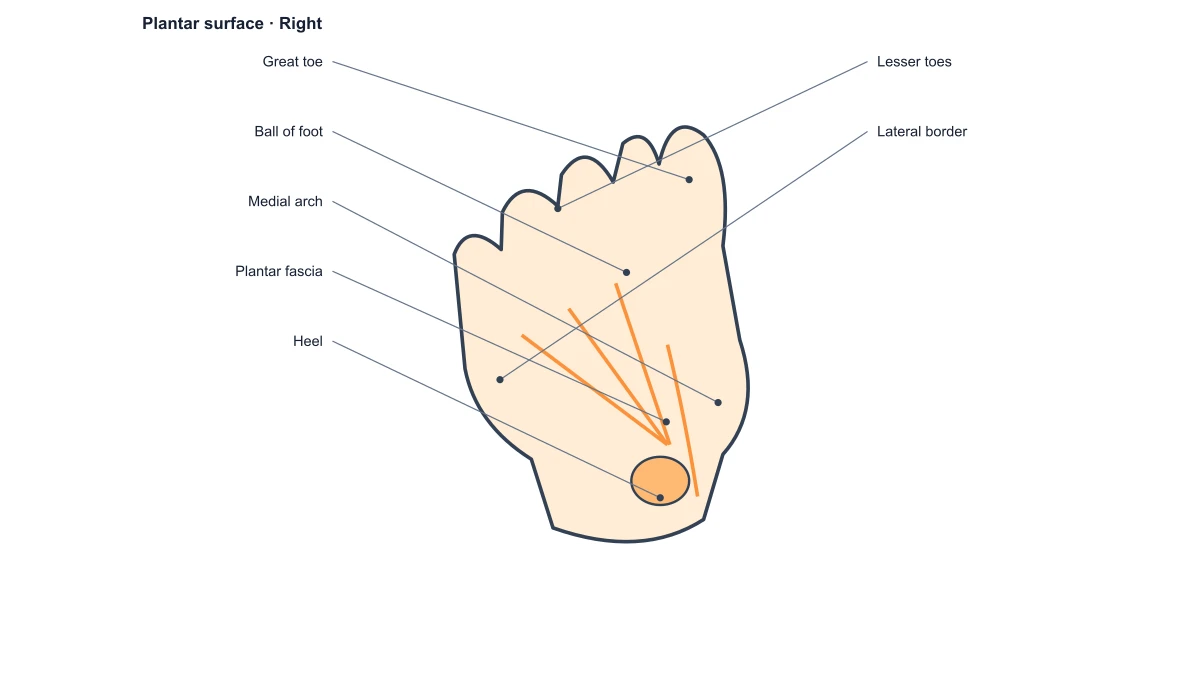 Plantar foot surface with heel, arch and fascia labels
