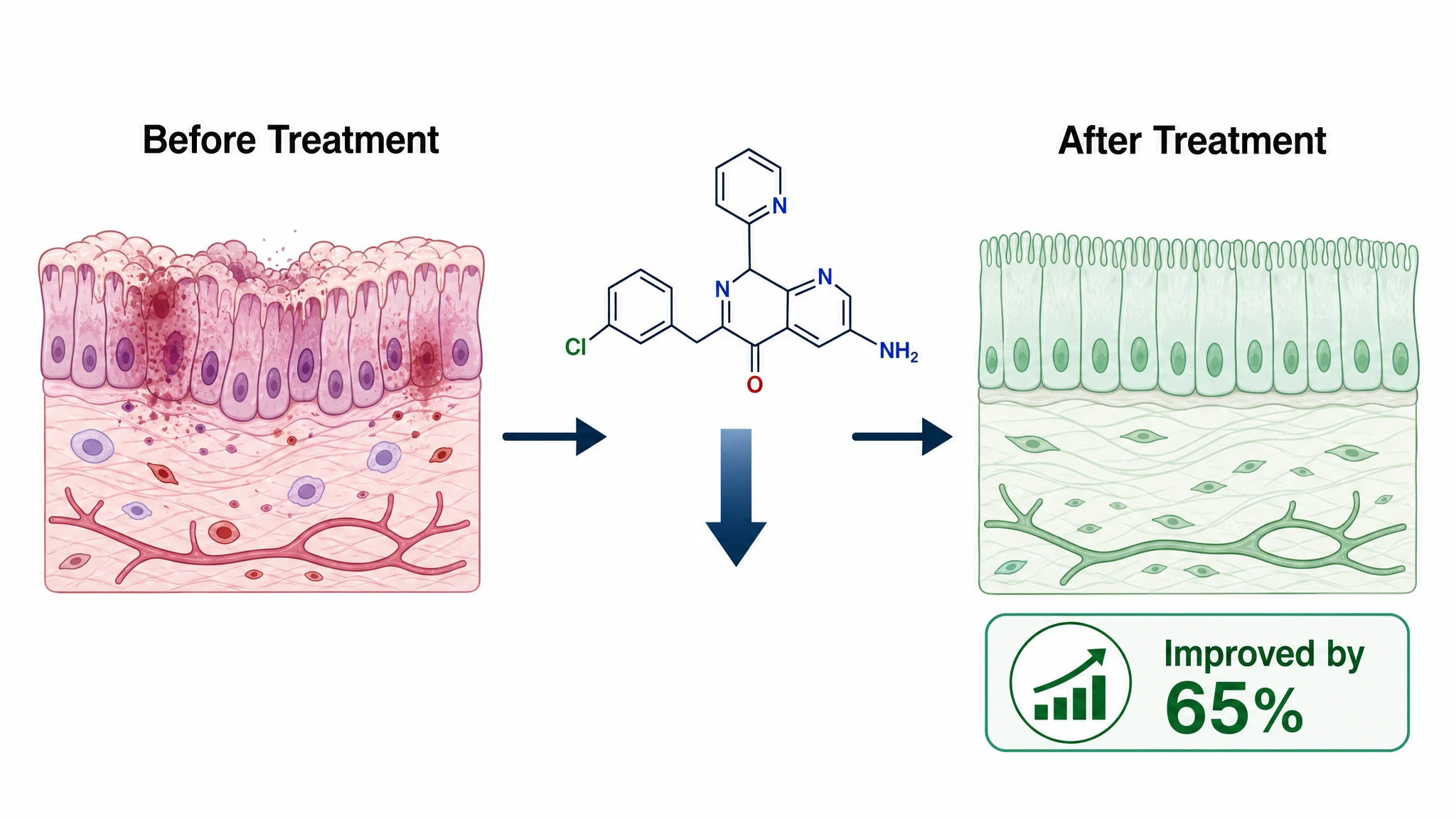 Before-and-after graphical abstract panel showing disease state, treatment intervention, and improved outcome (Figure generated with SciFig)